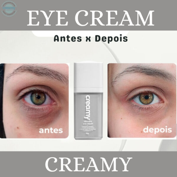 Creamy Eye Cream Área dos Olhos - Redutor de Olheiras - Image 2