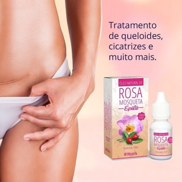 Epilê Óleo Natural de Rosa Mosqueta 10ml - Image 2